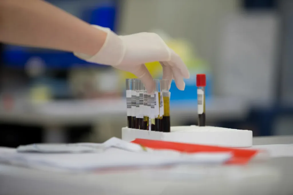 Probówki z próbkami krwi na stanowisku laboratoryjnym